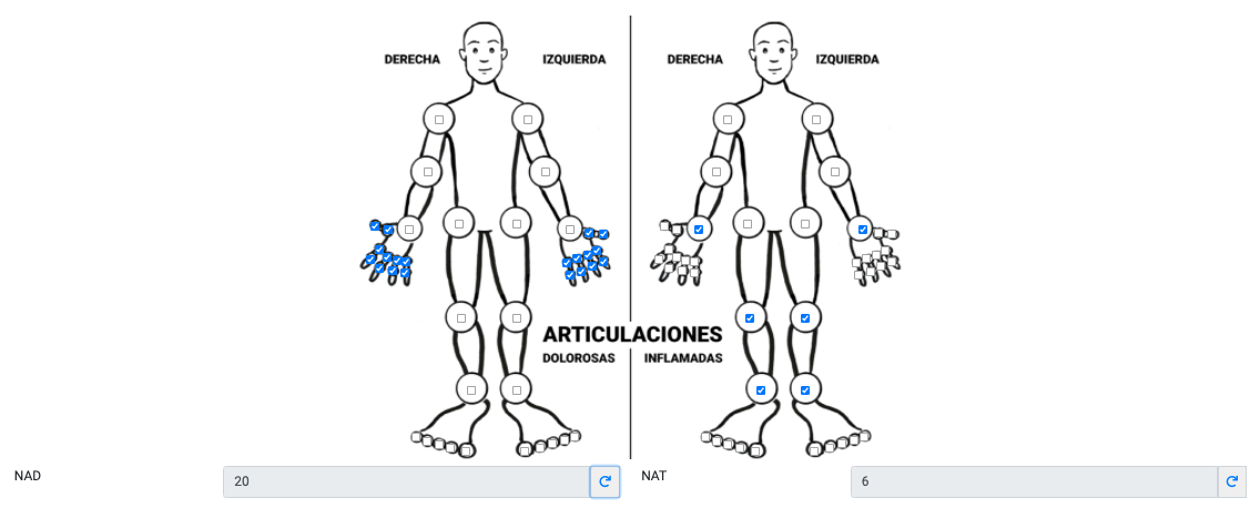 Homúnculo de reumatología